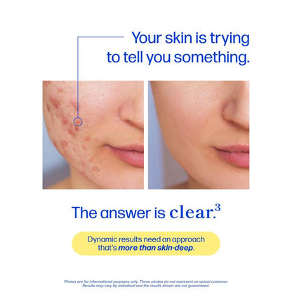 Votocol Clear Skin Support