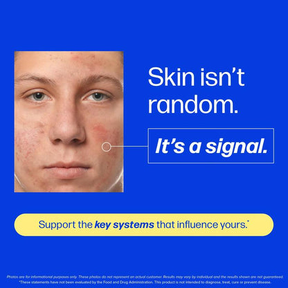 Votocol Clear Skin Support