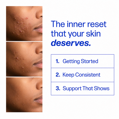 Votocol Clear Skin Support